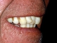 Konig Center for Cosmetic & Comprehensive Dentistry smile photos